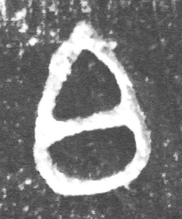 金文·裘卫簋·白