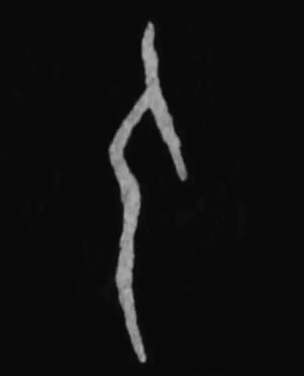 殷墟甲骨文·人