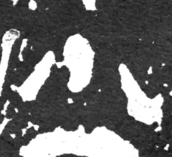 金文·毛公鼎铭文·小