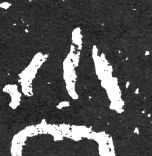 金文·毛公鼎铭文·小