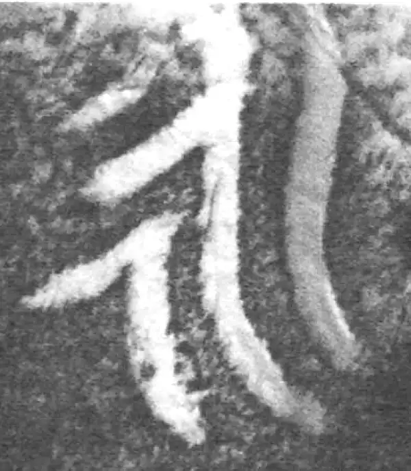 金文·南宫乎钟·永