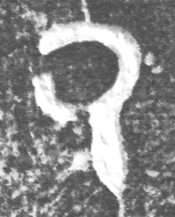 金文·(冬戈)方鼎甲·厥